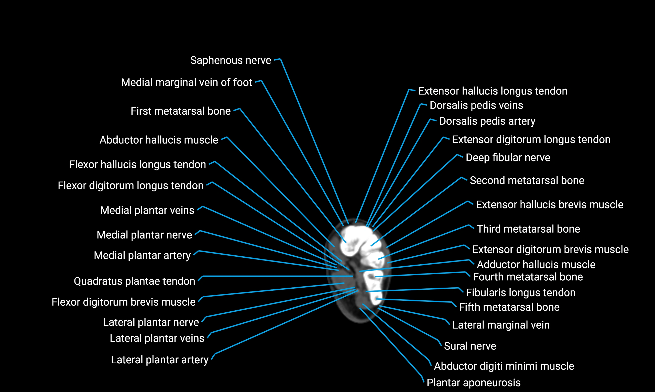 CT lower limb axial cross sectional anatomy labelled image 181 (2).webp